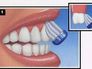 brushing diagram