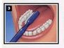 brushing diagram