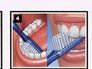 brushing diagram