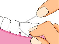 flossing diagram